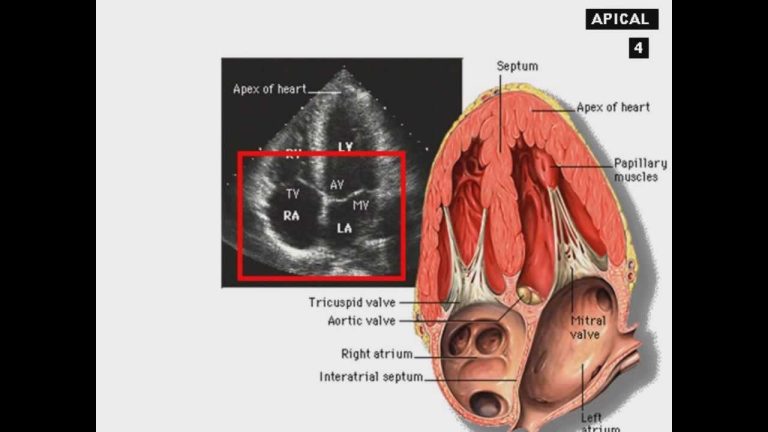 ECHO Cardiography