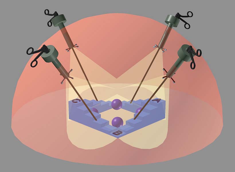 Laparoscopy